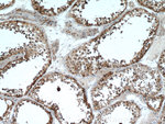 VPS45 Antibody in Immunohistochemistry (Paraffin) (IHC (P))