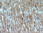 VPS45 Antibody in Immunohistochemistry (Paraffin) (IHC (P))