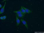 CAMP Antibody in Immunocytochemistry (ICC/IF)