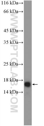 CAMP Antibody in Western Blot (WB)