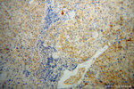 SERPINA6 Antibody in Immunohistochemistry (Paraffin) (IHC (P))