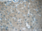 SERPINA6 Antibody in Immunohistochemistry (Paraffin) (IHC (P))