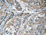 SERPINA6 Antibody in Immunohistochemistry (Paraffin) (IHC (P))