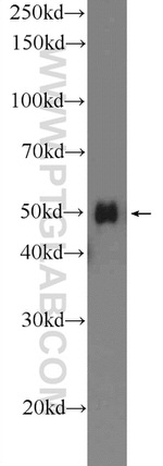 SERPINA6 Antibody in Western Blot (WB)