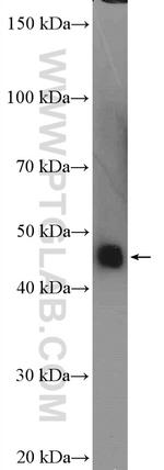 SERPINA6 Antibody in Western Blot (WB)