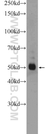 SERPINA6 Antibody in Western Blot (WB)