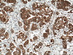 SMYD3 Antibody in Immunohistochemistry (Paraffin) (IHC (P))