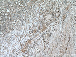 SMYD3 Antibody in Immunohistochemistry (Paraffin) (IHC (P))