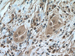 SMYD3 Antibody in Immunohistochemistry (Paraffin) (IHC (P))