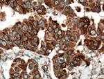 SMYD3 Antibody in Immunohistochemistry (Paraffin) (IHC (P))