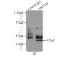 SMYD3 Antibody in Immunoprecipitation (IP)