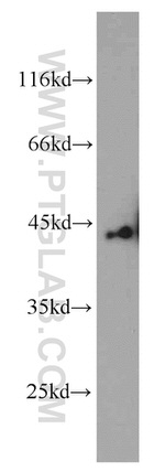 SMYD3 Antibody in Western Blot (WB)