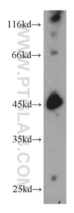 SMYD3 Antibody in Western Blot (WB)