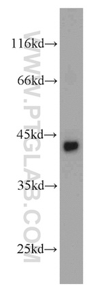 SMYD3 Antibody in Western Blot (WB)