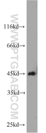 SMYD3 Antibody in Western Blot (WB)