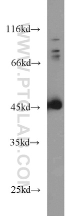 SMYD3 Antibody in Western Blot (WB)