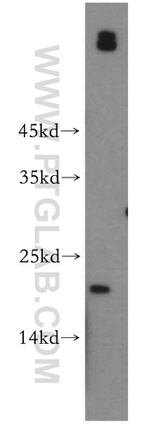 UBE2G1 Antibody in Western Blot (WB)