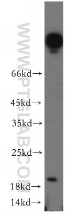 UBE2G1 Antibody in Western Blot (WB)