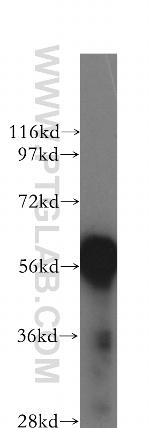 CHST10 Antibody in Western Blot (WB)