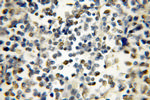 IKZF1 Antibody in Immunohistochemistry (Paraffin) (IHC (P))