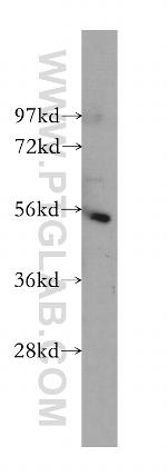 IKZF1 Antibody in Western Blot (WB)