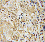 TFAP4 Antibody in Immunohistochemistry (Paraffin) (IHC (P))