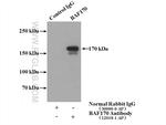 BAF170 Antibody in Immunoprecipitation (IP)