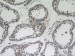 SPATA7 Antibody in Immunohistochemistry (Paraffin) (IHC (P))