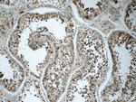 SPATA7 Antibody in Immunohistochemistry (Paraffin) (IHC (P))