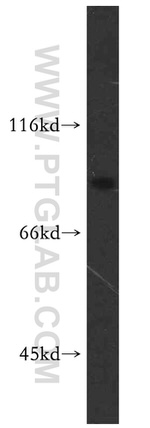 SPATA7 Antibody in Western Blot (WB)