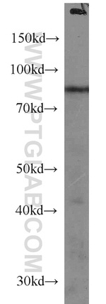 SPATA7 Antibody in Western Blot (WB)