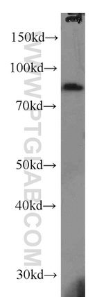 SPATA7 Antibody in Western Blot (WB)