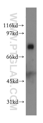 SPATA7 Antibody in Western Blot (WB)