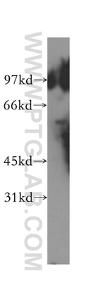 TBCE Antibody in Western Blot (WB)