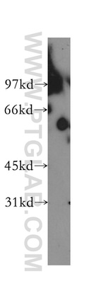 TBCE Antibody in Western Blot (WB)