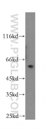 TBCE Antibody in Western Blot (WB)