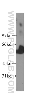 TBCE Antibody in Western Blot (WB)