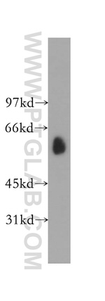 TBCE Antibody in Western Blot (WB)