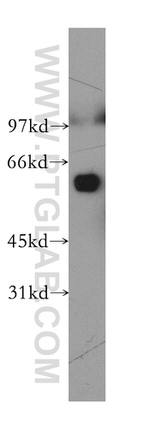 TBCE Antibody in Western Blot (WB)