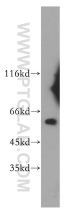 TBCE Antibody in Western Blot (WB)