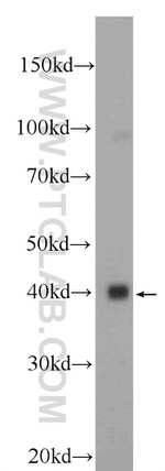 NUCKS1 Antibody in Western Blot (WB)