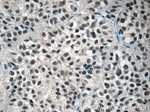 NUSAP1 Antibody in Immunohistochemistry (Paraffin) (IHC (P))