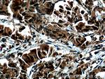 NUSAP1 Antibody in Immunohistochemistry (Paraffin) (IHC (P))
