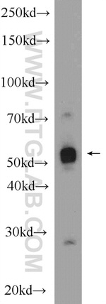 NUSAP1 Antibody in Western Blot (WB)