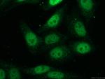 HOXC10 Antibody in Immunocytochemistry (ICC/IF)