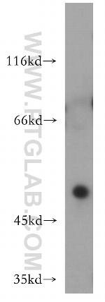 HOXC10 Antibody in Western Blot (WB)