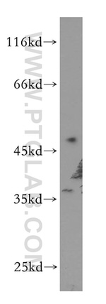 HOXC10 Antibody in Western Blot (WB)