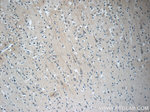 STMN4 Antibody in Immunohistochemistry (Paraffin) (IHC (P))