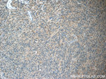 STMN4 Antibody in Immunohistochemistry (Paraffin) (IHC (P))