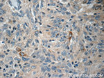 STMN4 Antibody in Immunohistochemistry (Paraffin) (IHC (P))